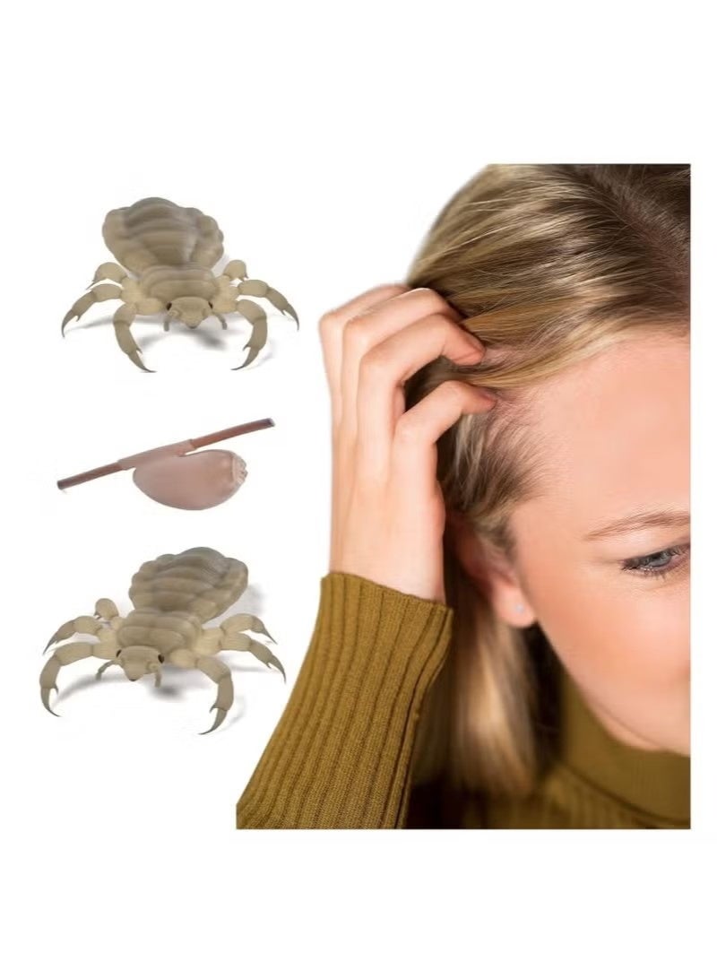 مشط القمل - مشط احترافي من الفولاذ المقاوم للصدأ - نتائج سريعة لعلاج قمل الرأس - مناسب لجميع أنواع الشعر | مشط القشرة | مشط الصدفية - فرشاة القمل (عبوتان) - Image 5